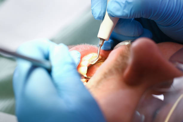 Best Emergency Dental Care for Broken or Chipped Teeth in Elm City, NC