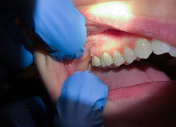 Best Emergency TMJ Treatment in Elm City, NC